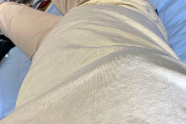 女性化 乳房 育乳 乳腺発達 ホル乳 男性機能