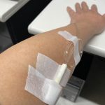 高濃度ビタミンC点滴