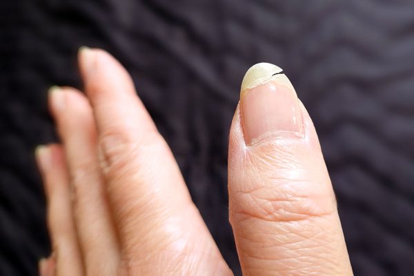 ネイル 爪割れ